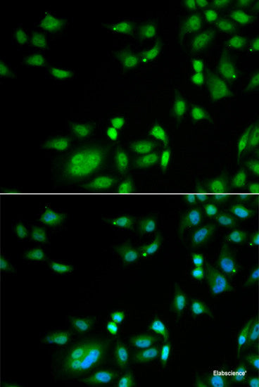 Immunohistochemistry of paraffin-embedded Rat liver using UGDH Polyclonal Antibody at dilution of 1:100 (40x lens).