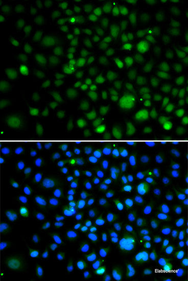 Western blot analysis of extracts of Mouse kidney using USF1 Polyclonal Antibody at dilution of 1:1000.