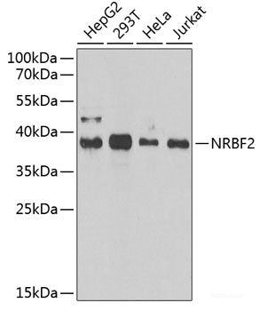 Immunohistochemistry of paraffin-embedded Human kidney cancer using HAUSP / USP7 Polyclonal Antibody at dilution of 1:200 (40x lens).