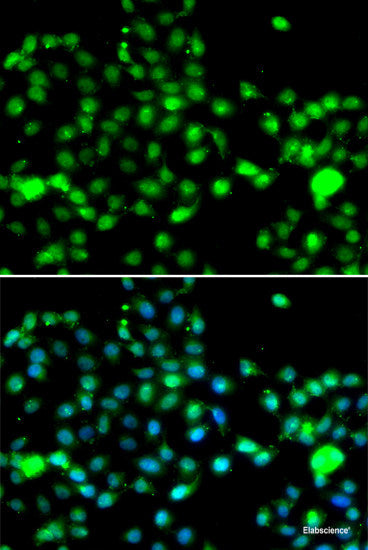 Immunofluorescence analysis of MCF-7 cells using TNFSF13 Polyclonal Antibody