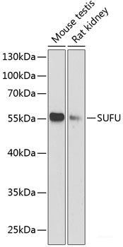 Immunohistochemistry of paraffin-embedded Human colon using PICK1 Polyclonal Antibody at dilution of 1:100 (40x lens).
