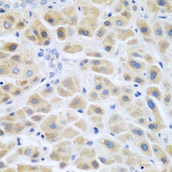 Immunofluorescence analysis of A549 cells using NCS1 Polyclonal Antibody