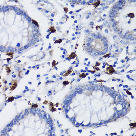 Immunofluorescence analysis of HeLa cells using CD177 Polyclonal Antibody