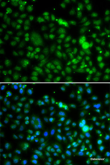 Immunohistochemistry of paraffin-embedded Rat testis using APOBEC3G Polyclonal Antibody at dilution of 1:100 (40x lens).
