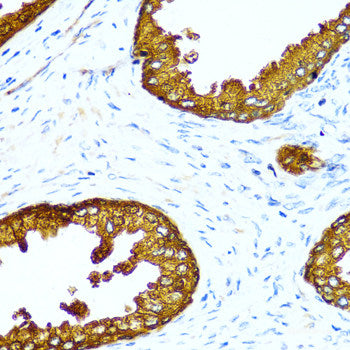Immunofluorescence analysis of A549 cells using KIF2B Polyclonal Antibody