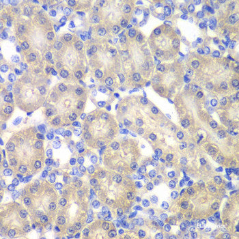 Immunohistochemistry of paraffin-embedded Rat brain using WNT3A Polyclonal Antibody at dilution of 1:200 (40x lens).