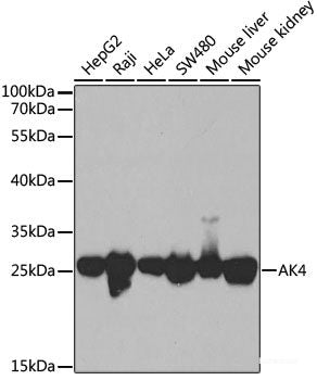 Western blot analysis of extracts of A549 cells using SPDYA Polyclonal Antibody at dilution of 1:1000.