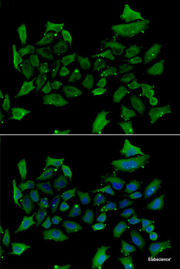 Western blot analysis of extracts of Rat skin using TYR Polyclonal Antibody at dilution of 1:3000.