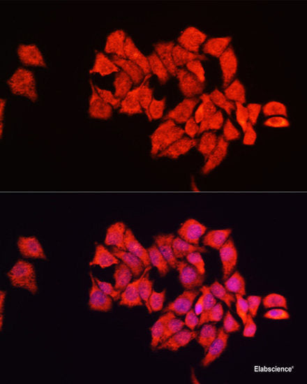 Western blot analysis of extracts of Raji cells using CD38 Polyclonal Antibody at dilution of 1:1000.