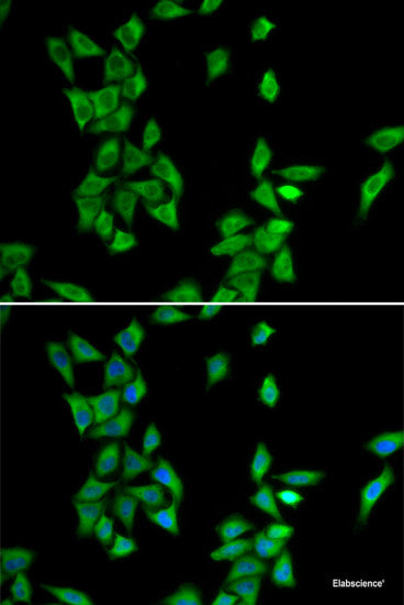 Western blot analysis of extracts of various cell lines using EIF4G2 Polyclonal Antibody at dilution of 1:1000.