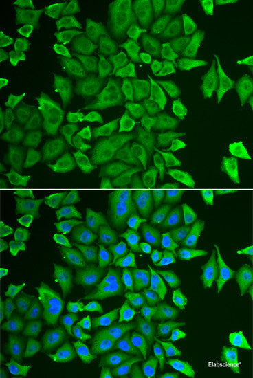 Western blot analysis of extracts of 293T cells using FIGF Polyclonal Antibody at dilution of 1:1000.