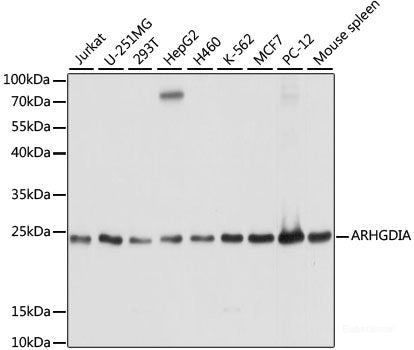 Western blot analysis of extracts of various cell lines using KLRD1 Polyclonal Antibody at dilution of 1:3000.