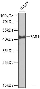 Immunohistochemistry of paraffin-embedded Mouse lung using PRKCB Polyclonal Antibody at dilution of 1:200 (40x lens).