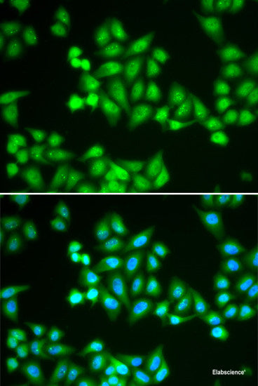 Western blot analysis of extracts of various cell lines using PSMB2 Polyclonal Antibody at dilution of 1:1000.