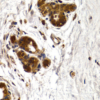 Immunofluorescence analysis of U2OS cells using TNFAIP3 Polyclonal Antibody