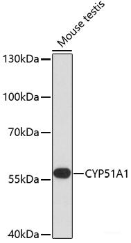 Immunofluorescence analysis of HeLa cells using CES2 Polyclonal Antibody