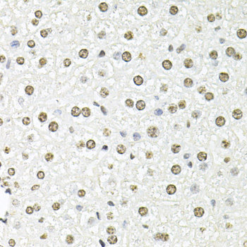 Immunohistochemistry of paraffin-embedded Rat brain using CPA6 Polyclonal Antibody at dilution of 1:100 (40x lens).