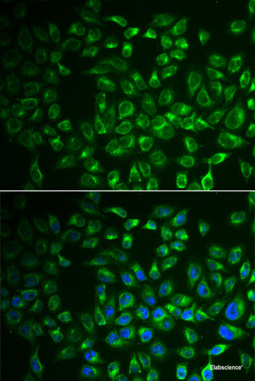 Immunohistochemistry of paraffin-embedded Human esophagus using INTS5 Polyclonal Antibody at dilution of 1:100 (40x lens).