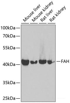 Western blot analysis of extracts of various cell lines using Uhrf2 Polyclonal Antibody at dilution of 1:1000.
