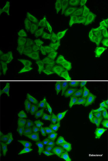 Western blot analysis of extracts of various cell lines using TNFRSF6B Polyclonal Antibody at dilution of 1:1000.