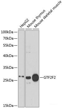 Immunofluorescence analysis of A549 cells using PRDM14 Polyclonal Antibody