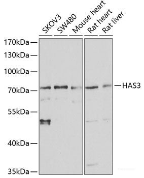 Western blot analysis of extracts of Rat liver using LAMB3 Polyclonal Antibody at dilution of 1:1000.