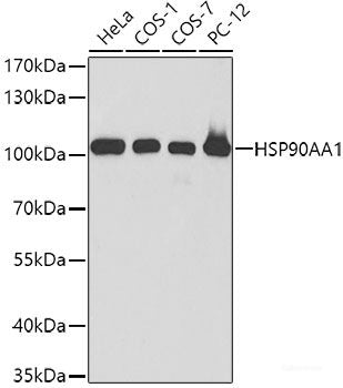 Immunohistochemistry of paraffin-embedded Rat testis using GLB1 Polyclonal Antibody at dilution of 1:200 (40x lens).