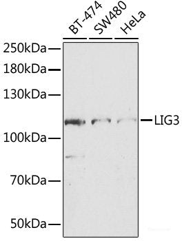 Immunofluorescence analysis of HeLa cells using C1S Polyclonal Antibody