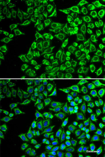 Immunohistochemistry of paraffin-embedded Mouse lung using CARS Polyclonal Antibody at dilution of 1:100 (40x lens).