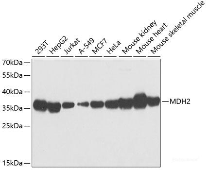 Western blot analysis of extracts of various cell lines using NR5A2 Polyclonal Antibody at dilution of 1:1000.