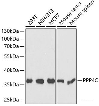 Immunohistochemistry of paraffin-embedded Human breast cancer using CABP7 Polyclonal Antibody at dilution of 1:100 (40x lens).
