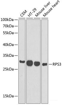 Western blot analysis of extracts of Mouse skeletal muscle using ADAP2 Polyclonal Antibody at dilution of 1:3000.