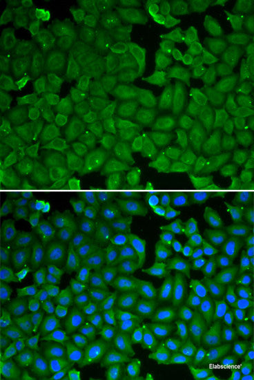 Immunohistochemistry of paraffin-embedded Mouse spleen using MPO Polyclonal Antibody at dilution of 1:100 (40x lens).