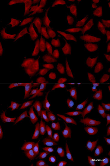 Western blot analysis of extracts of U-87MG cells using P3H4 Polyclonal Antibody at dilution of 1:3000.