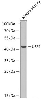 Western blot analysis of extracts of various cell lines using IFIT2 Polyclonal Antibody at dilution of 1:3000.