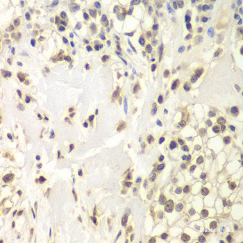 Immunohistochemistry of paraffin-embedded Rat liver using HSF1 Polyclonal Antibody at dilution of 1:100 (40x lens).