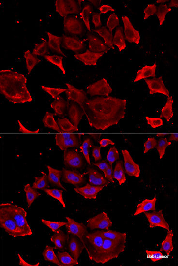Western blot analysis of extracts of 293T cells using P4HA3 Polyclonal Antibody at dilution of 1:3000.
