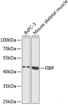 Western blot analysis of extracts of various cell lines using KLHL3 Polyclonal Antibody at dilution of 1:3000.