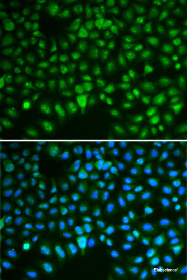 Immunohistochemistry of paraffin-embedded Rat liver using F3 Polyclonal Antibody at dilution of 1:100 (40x lens).