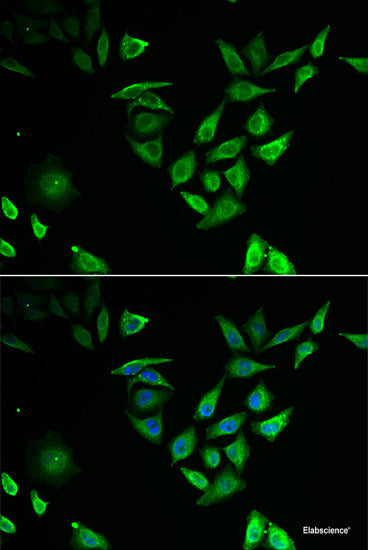 Western blot analysis of extracts of various cell lines using CAPN9 Polyclonal Antibody at dilution of 1:3000.