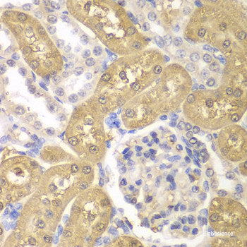 Immunofluorescence analysis of C6 cells using ABCB10 Polyclonal Antibody at dilution of 1:100. Blue: DAPI for nuclear staining.
