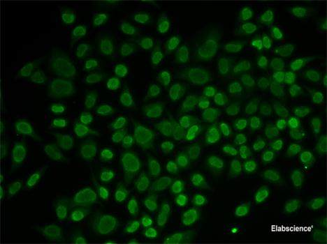 Western blot analysis of extracts of 293T cells using GLYAT Polyclonal Antibody at dilution of 1:3000.