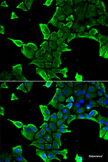 Western blot analysis of extracts of Mouse brain using SLC25A27 Polyclonal Antibody at dilution of 1:3000.