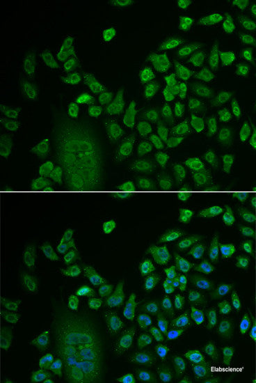 Western blot analysis of extracts of Mouse liver using CRACR2A Polyclonal Antibody at dilution of 1:3000.
