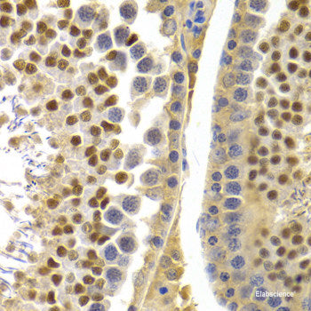 Immunohistochemistry of paraffin-embedded Rat brain using GANAB Polyclonal Antibody at dilution of 1:150 (40x lens).