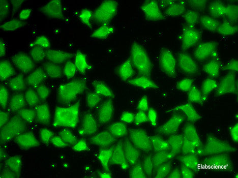 Western blot analysis of extracts of Mouse heart using GPAA1 Polyclonal Antibody at dilution of 1:3000.
