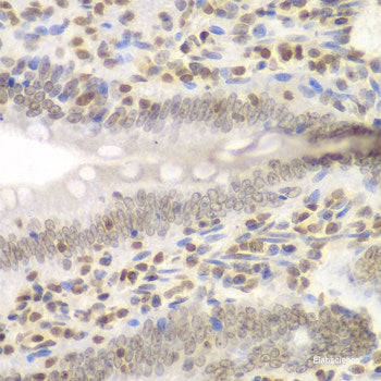Immunofluorescence analysis of HeLa cells using IGFBP5 Polyclonal Antibody
