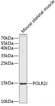 Western blot analysis of extracts of various cell lines using VSIG1 Polyclonal Antibody at dilution of 1:3000.