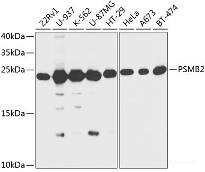 Immunofluorescence analysis of HepG2 cells using FCGR2A Polyclonal Antibody