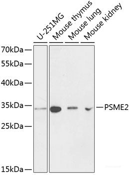 Western blot analysis of extracts of Jurkat cells using KRI1 Polyclonal Antibody at dilution of 1:3000.